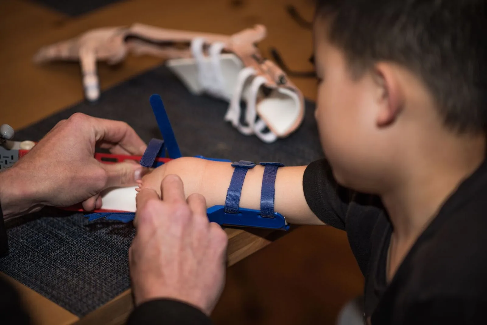 Prosthetic Arms — Pro bono